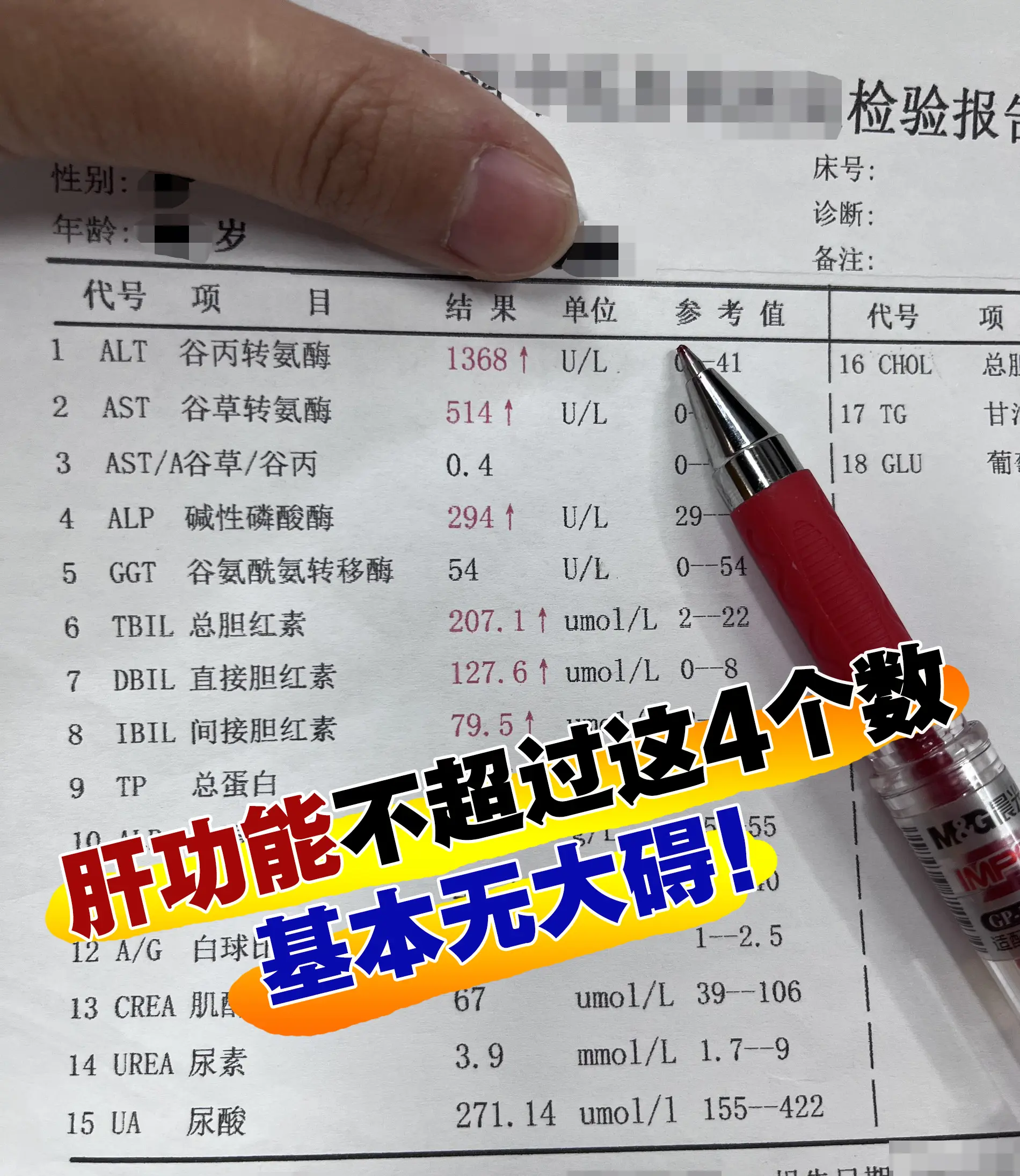 肝功能只要不超过这4个数，基本无大碍！  很多人拿到肝功能报告单就紧张...