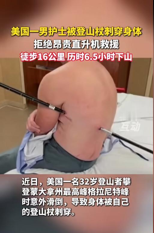 🌞“是个狠人！”7月29日报道，美国，一名32岁的男性登山者在和同伴一起攀