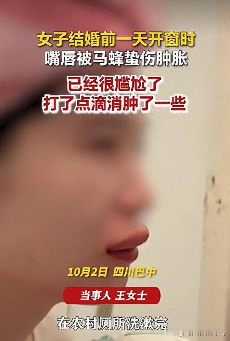 太揪心！四川巴中新娘婚前一天开窗嘴唇被马蜂蜇肿自嘲尴尬不已大喜日子前夕