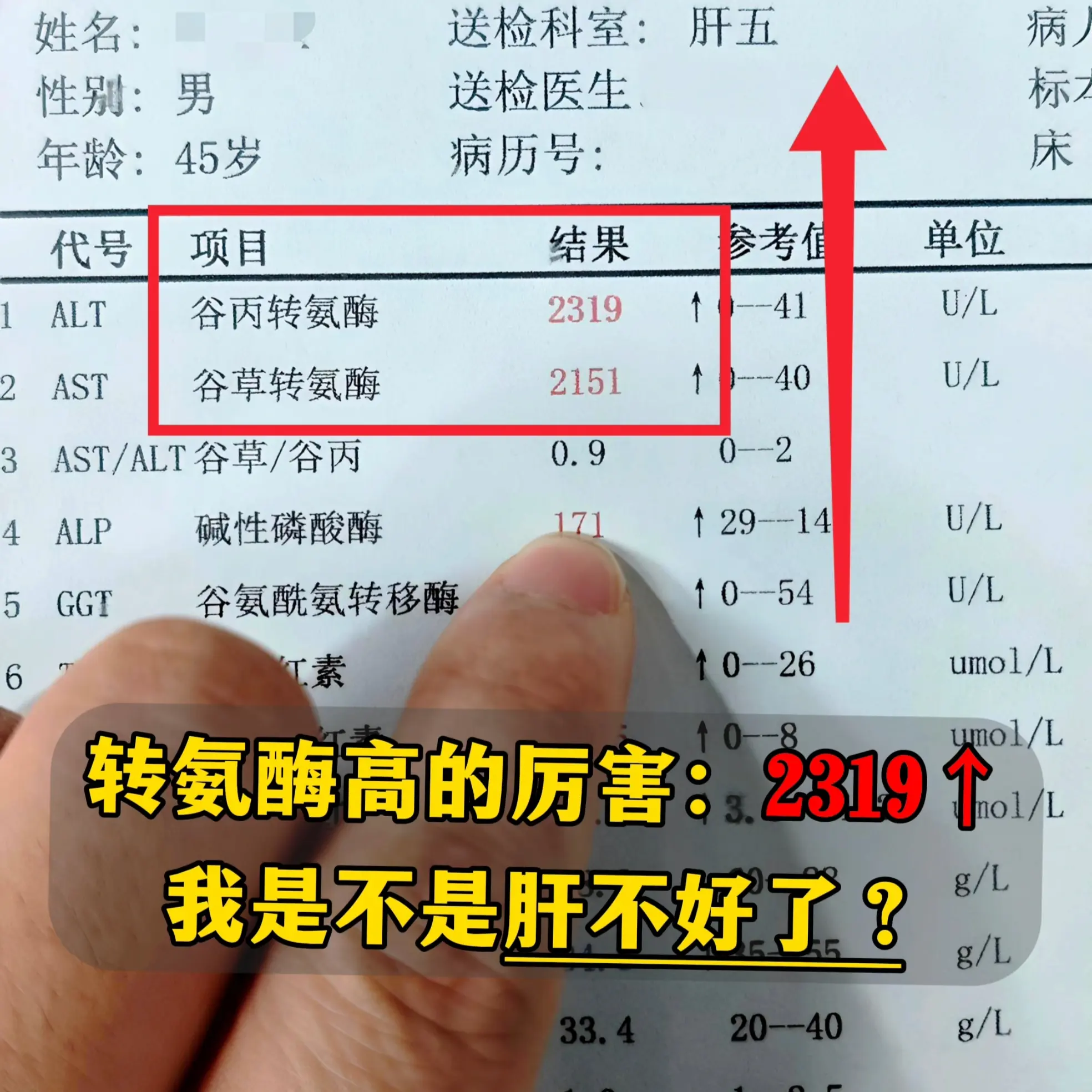 转氨酶这 1 项指标，一定程度上能代表肝脏受损情况，但不是所有情况都是...