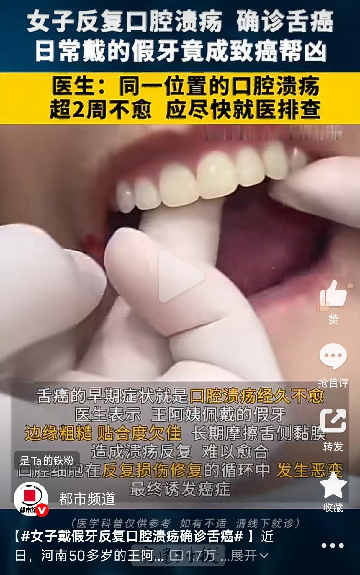 河南，一59岁女子口腔溃疡发作，去了医院以为开点药就能解决，没想到检查结果却让全