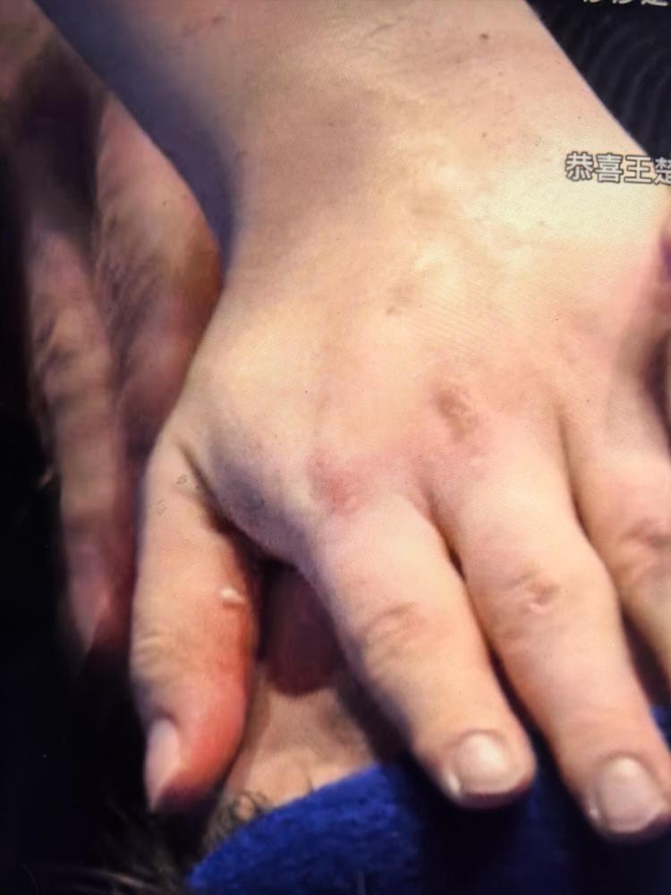 我告诉你，王楚钦这次夺冠的底牌，根本不是什么逆转基因，是自毁。他用废掉一条胳膊的