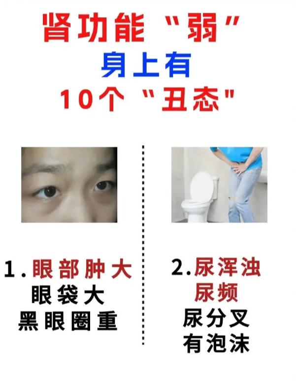 肾脏功能偏弱，身体会出现这10个信号