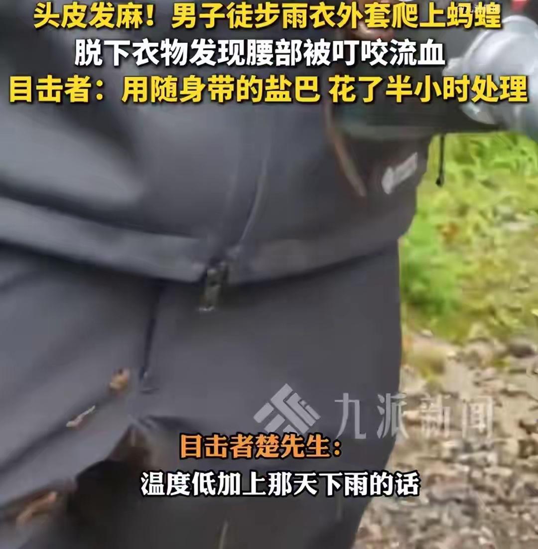 7月4日，云南昆明，一男子徒步时身上爬有多只蚂蝗。7月6日，目击者楚先生告诉记者