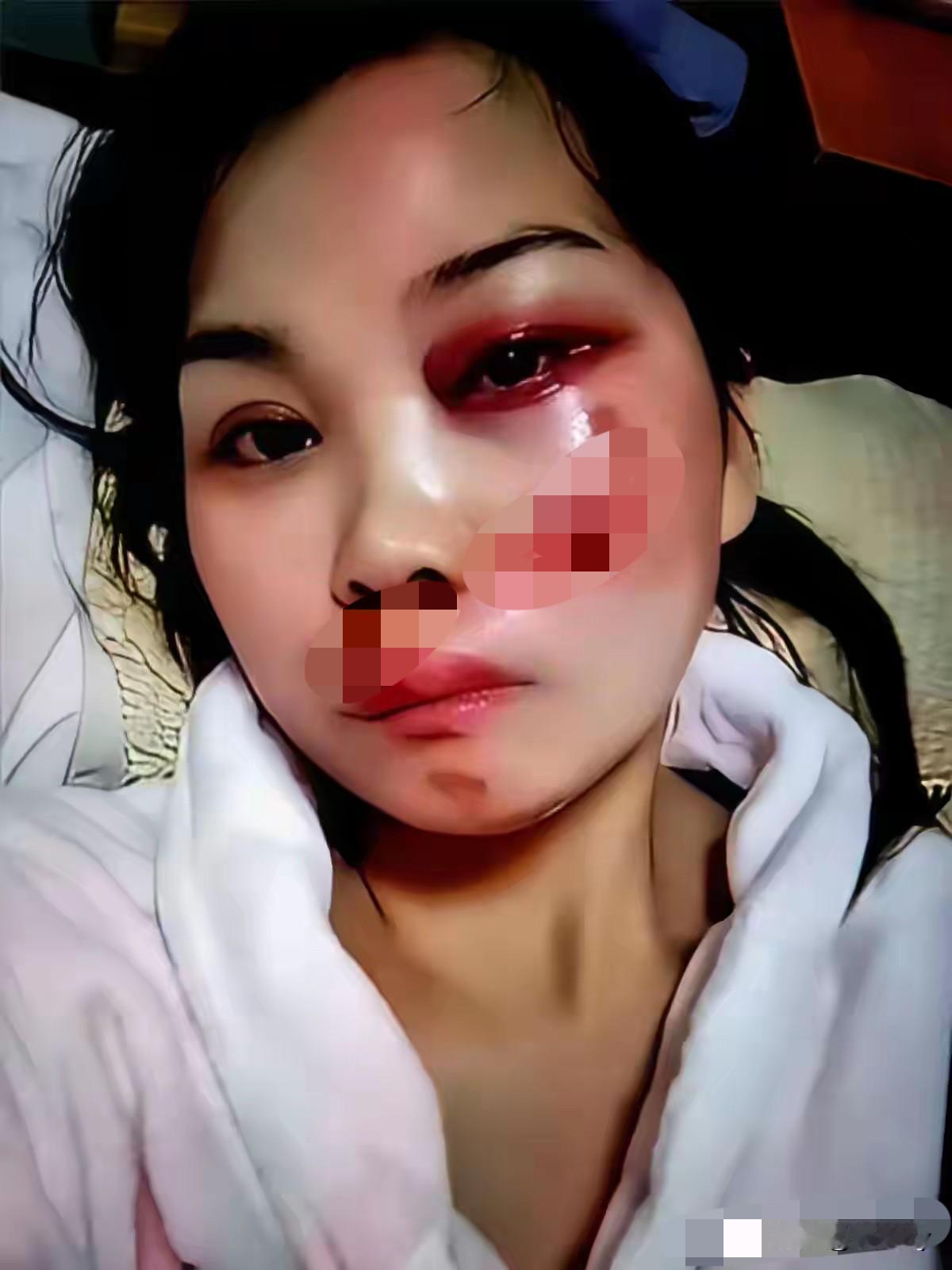 刘女士真是悔不当初啊！刘女士发布了自己被老公家暴打伤的视频，播放量很快就突破了2