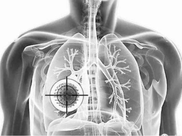 当我们还在习惯用“刀切”式的治疗方式时，医学的脚步已经悄然发生了革命。这不仅仅是