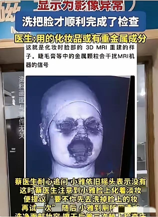 福建一个29岁姑娘去做头颅磁共振，差点没把医生整崩溃。连着扫了两次，机器都提示