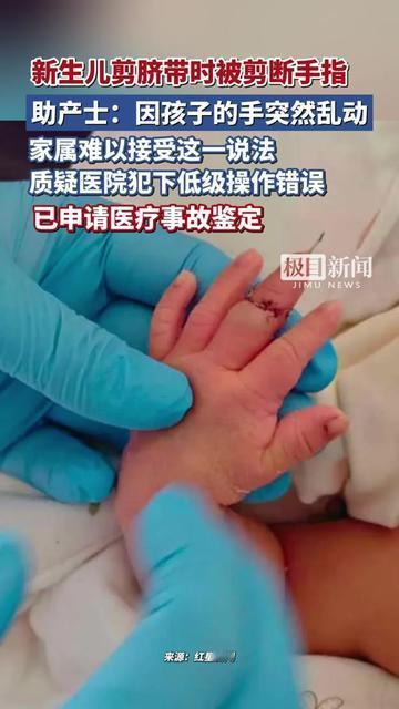 刚听到宝宝哭声的妈妈，还没笑出来就傻了！护士抱着孩子说：“剪脐带时，宝宝