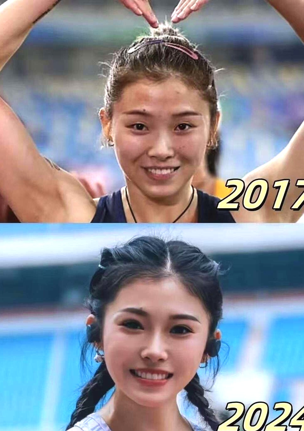 就连这么优秀的她，都要整容。