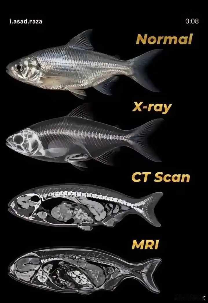 网友：一张图将x光，CT和磁共振成像效果显示得淋漓尽致！