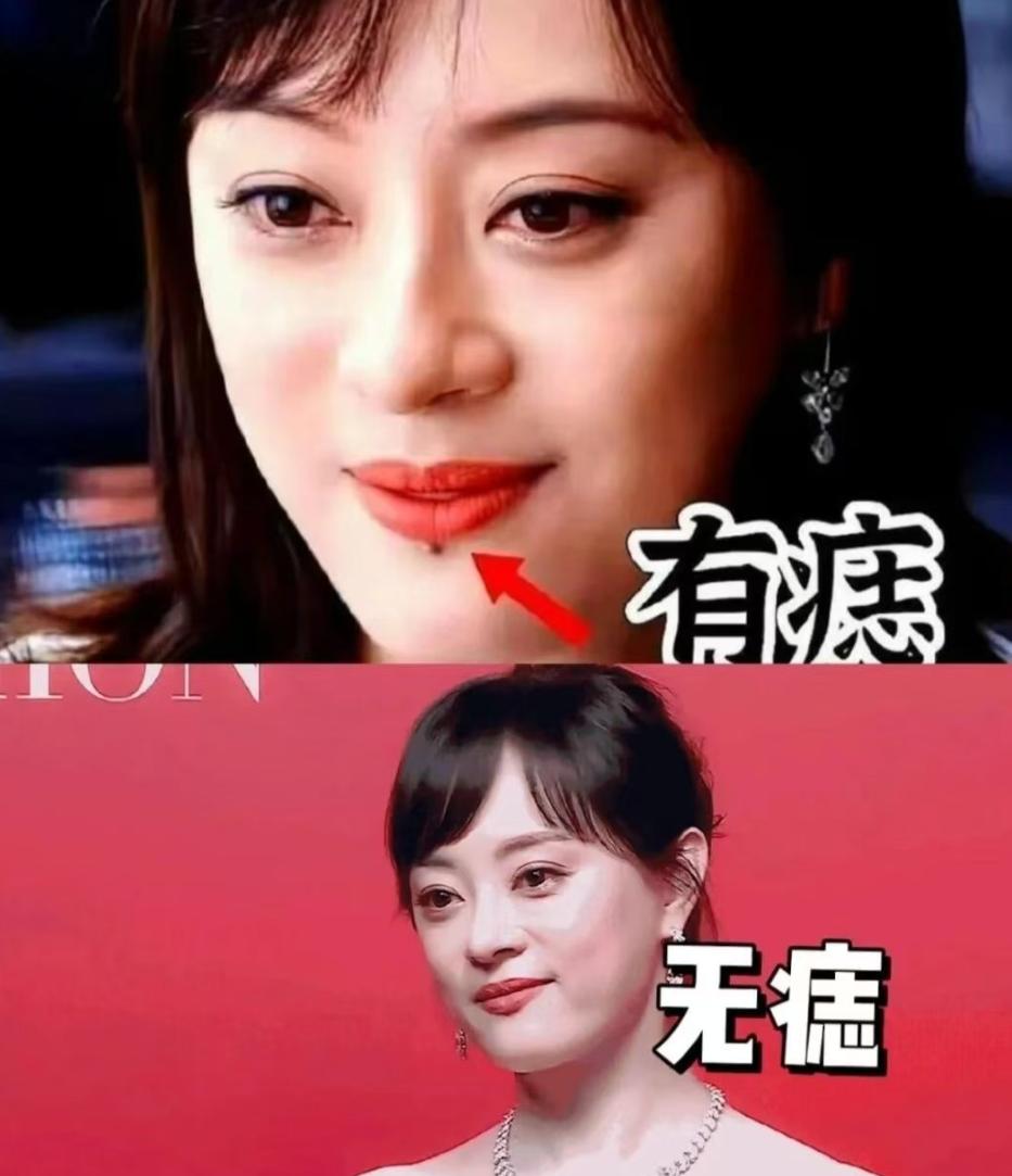 孙俪唇下痣消失，不是去什么地方整了纯粹是因为那根本不是痣最近刷没刷到