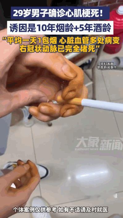 “果然吸烟有害身体健康”一个年仅29岁的小伙子，在人生最该肆意挥洒青春的年纪，却