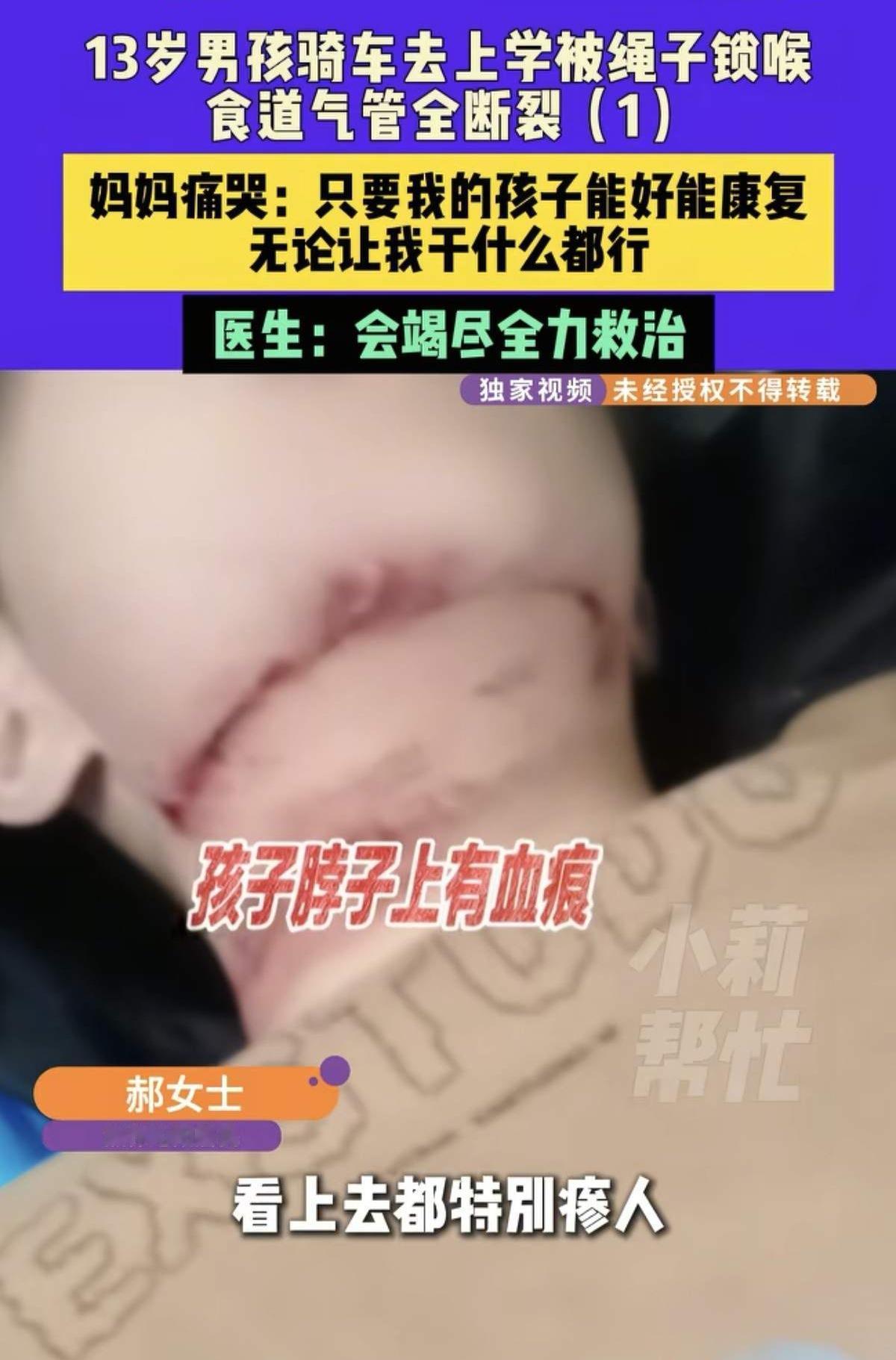 看了河南焦作13岁男孩被绳子勒喉，我立马做了这3个决定：第1.骑车的时候要戴