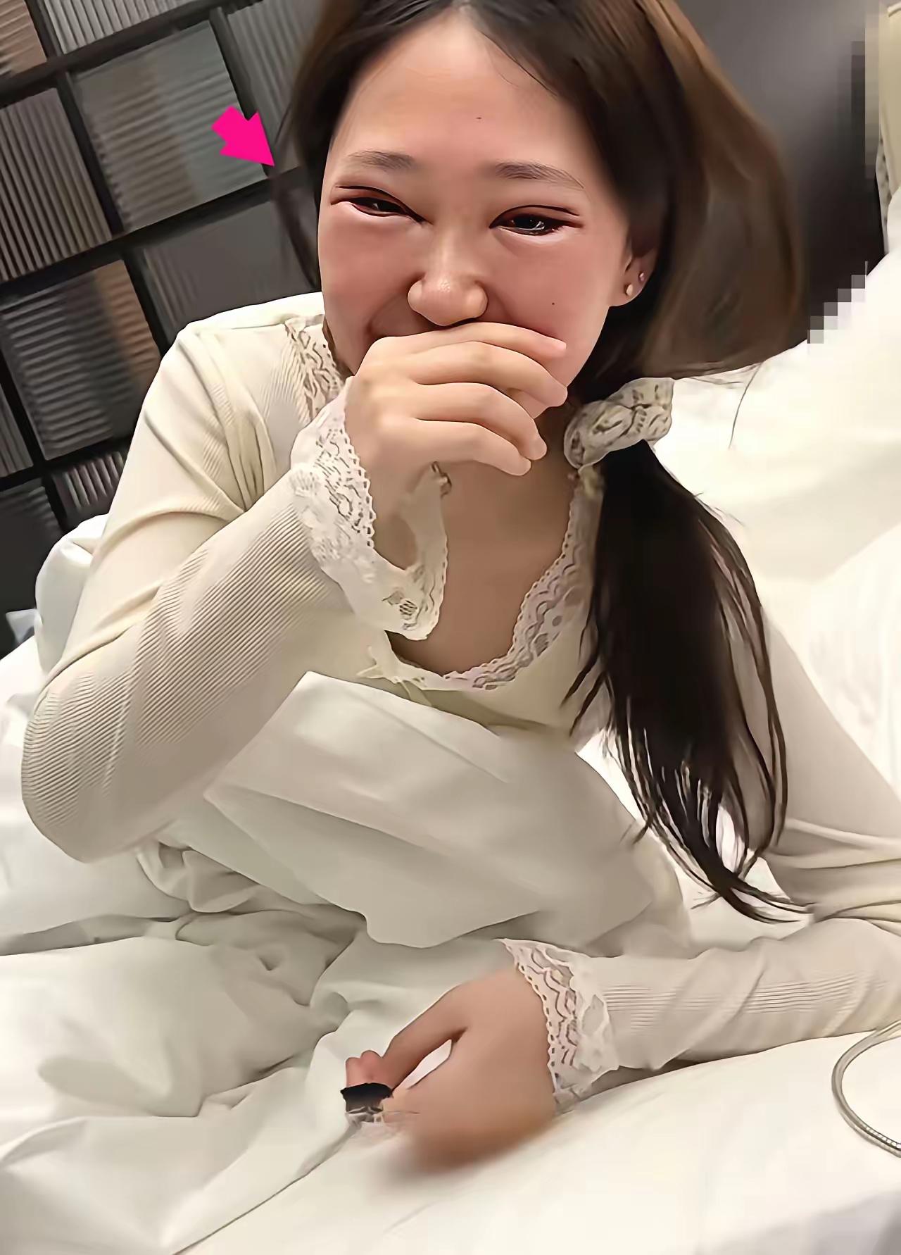这样割的双眼皮好看吗？这位女子说，她花了一万元割了双眼皮，让大家看看，是否漂