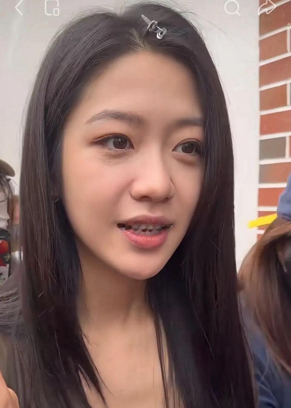 向涵之皮肤状态真的好差啊，感觉好胯啊