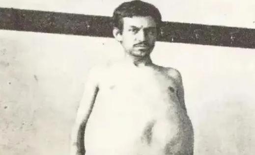 1940年，一位美国男子正在排泄大便时突然死亡，当法医检查过后，却发现男子的体内