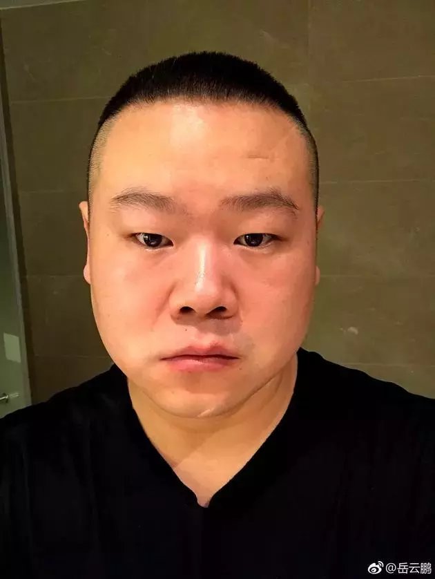 岳云鹏被诊断出高血压和脑梗, 感叹一辈子挣的钱, 1/3都拿来看病了!