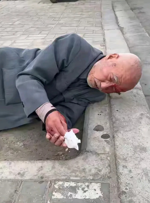 这个社会也太冷漠了！一位老大爷摔倒在地，许久都没能起身。他的手和眼睛磕破了，正