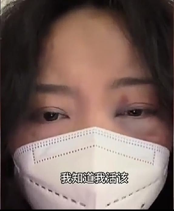 女子网恋菲律宾网友奔现！结果差点把命都搭上了，对方用拳头和棍子，把女子打的鼻青脸