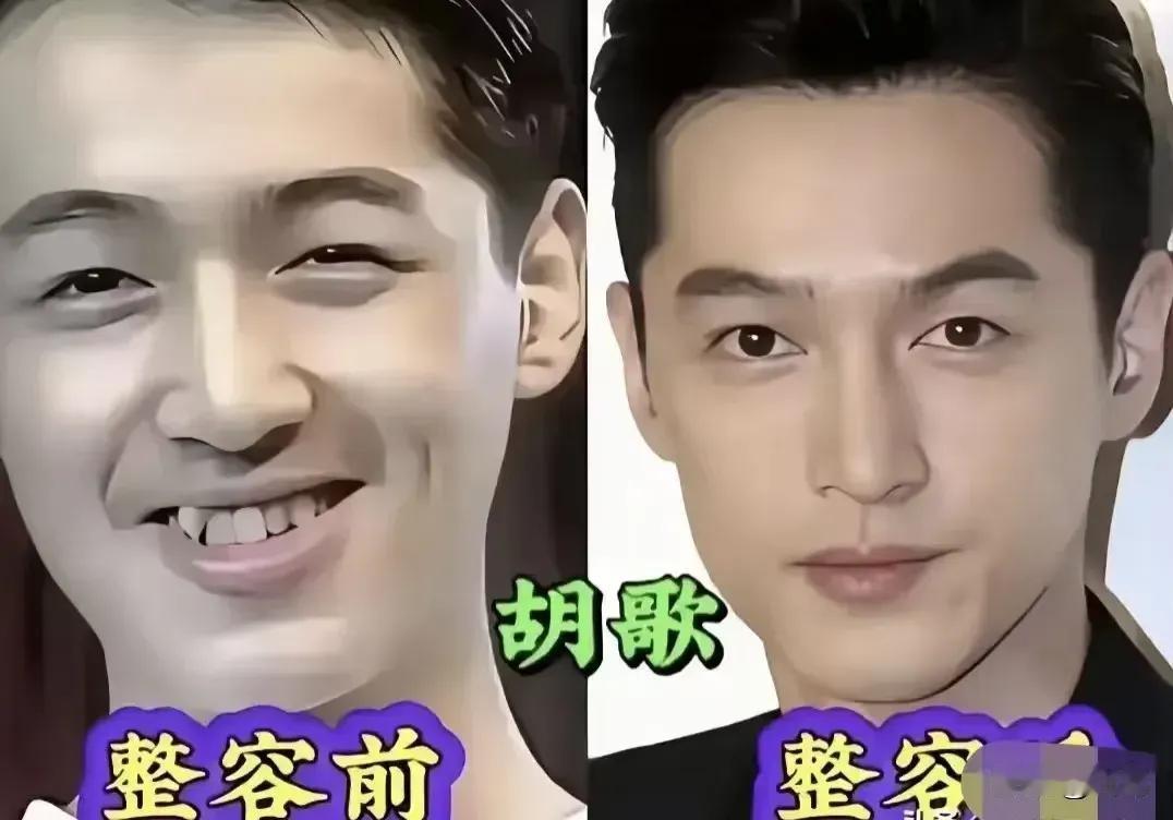 整过容的胡歌。整过容的郑元畅。整过容的吴刚。整过容的苏有朋。整过容的汪东