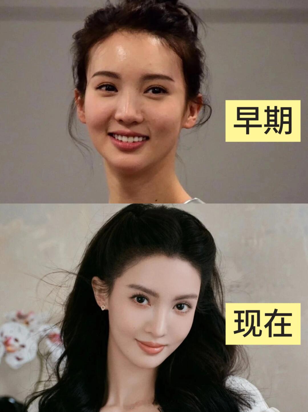 金晨的鼻子为啥一直在变？​​​