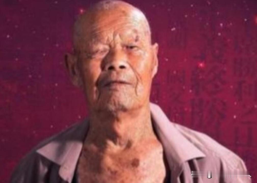 1956年，35岁农民咳嗽10年，竟拒绝就医，一天，他突然用力咳嗽，“哇”的一声