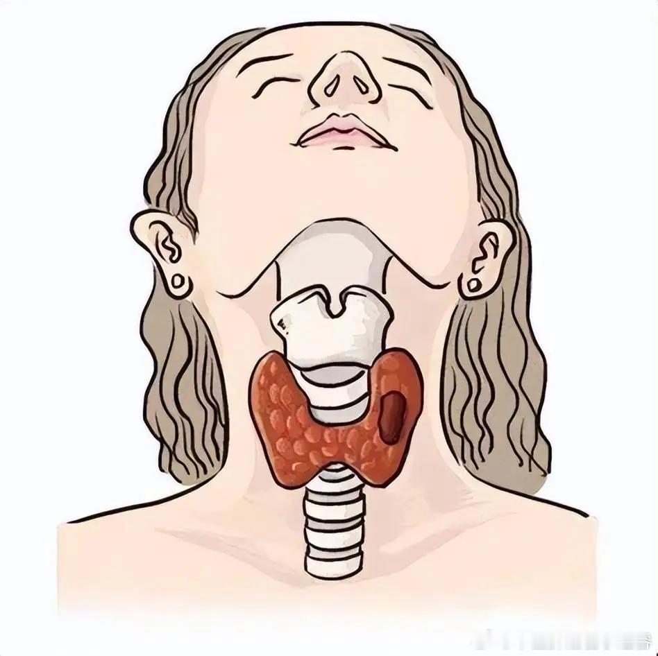 【发现甲状腺结节该怎么办？】健闻登顶计划国医的精诚力量甲状腺结节很常见，通过