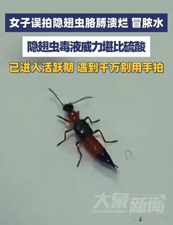 真的后怕！5月29日，浙江义乌一位女士在家窗边撞见一只小飞虫，下意识抬手就拍。谁