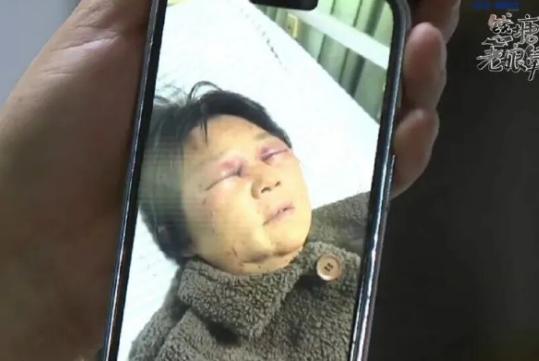 太离谱！婆婆帮忙带娃，反倒被儿媳打断4根肋骨。面对受伤的母亲，儿子的辩解更是让人