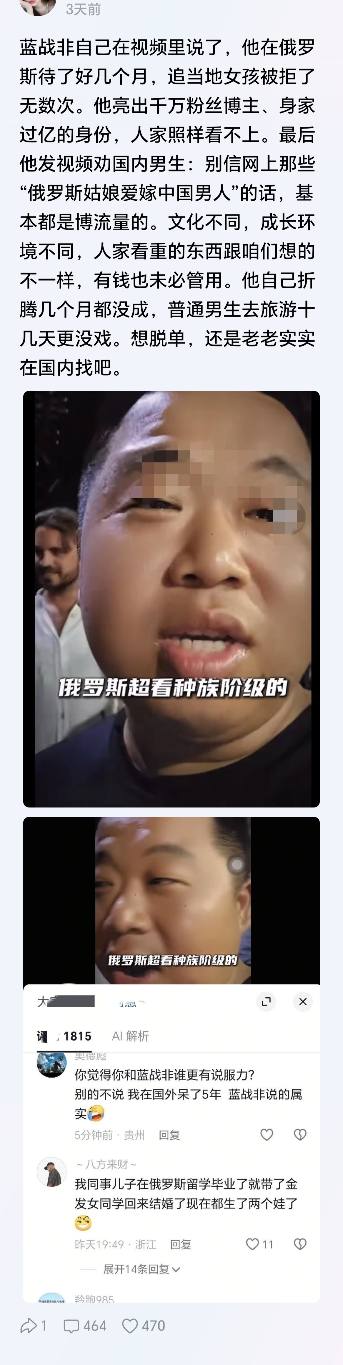 蓝战非这颜值，在国内也不好找吧，如果不知道他是网红千万身价，我估计打光棍一辈子[