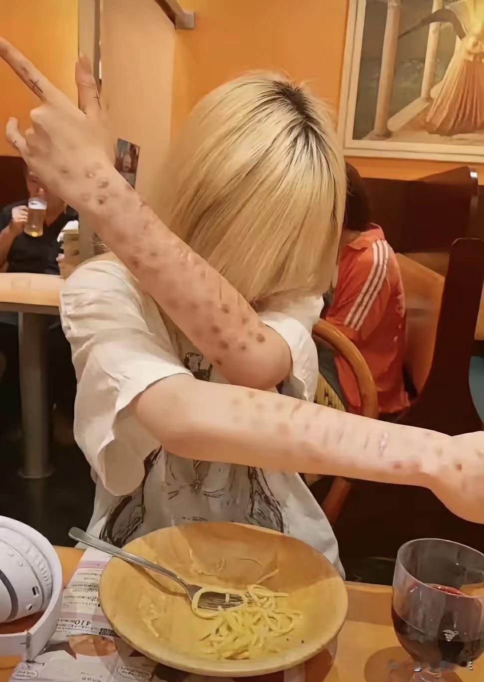 日本年轻人将感染梅毒视为一种值得炫耀的经历，梅毒装在日本成了潮流，他们还在网上组