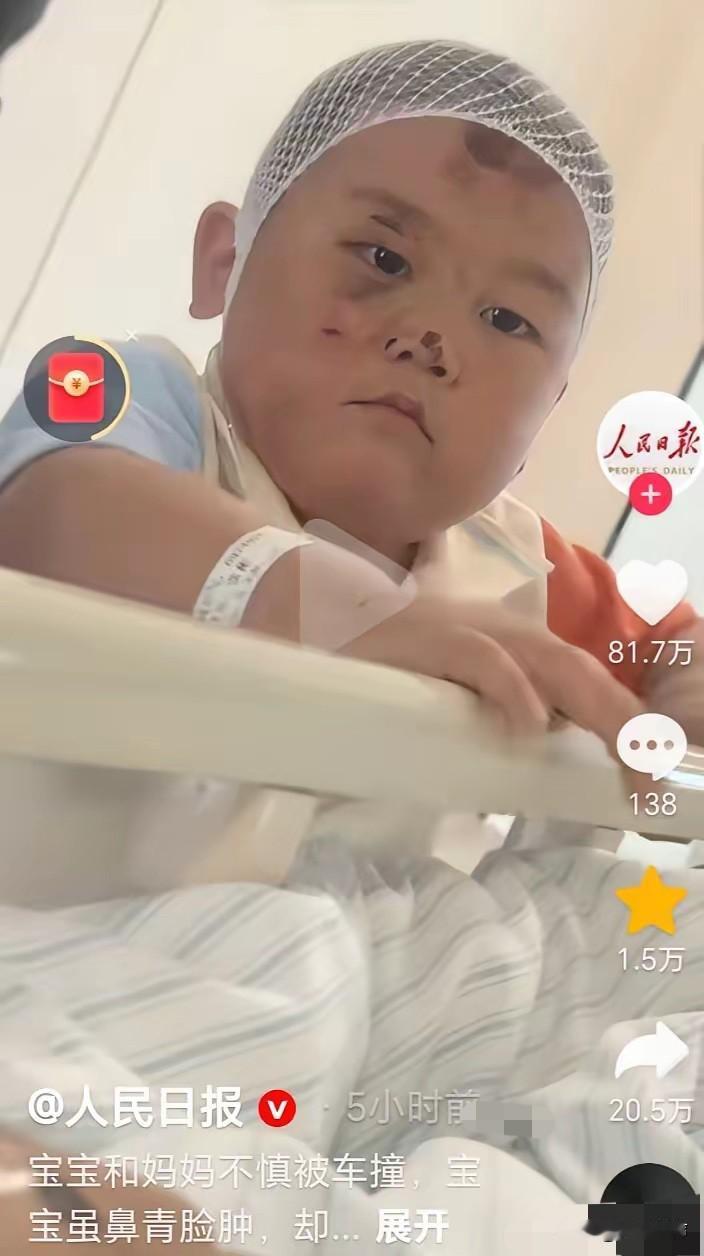 鼻青脸肿的宝宝上人民日报了，明明也受伤了，也很痛，却不哭不闹的跟随着妈妈，眼神坚