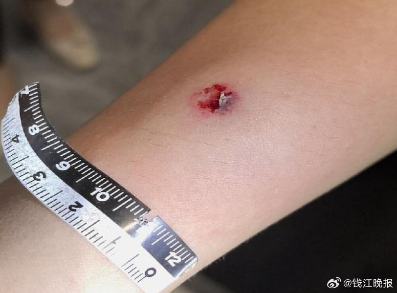 【#司机等红灯向路人射钢珠致4人受伤#】“就想找点乐子，没想到闯了这么大的祸。”
