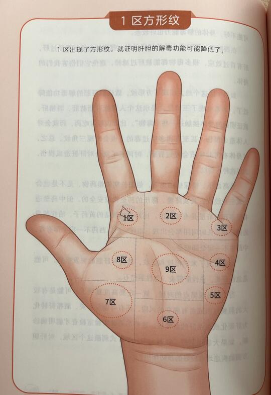 中医：看手相识健康