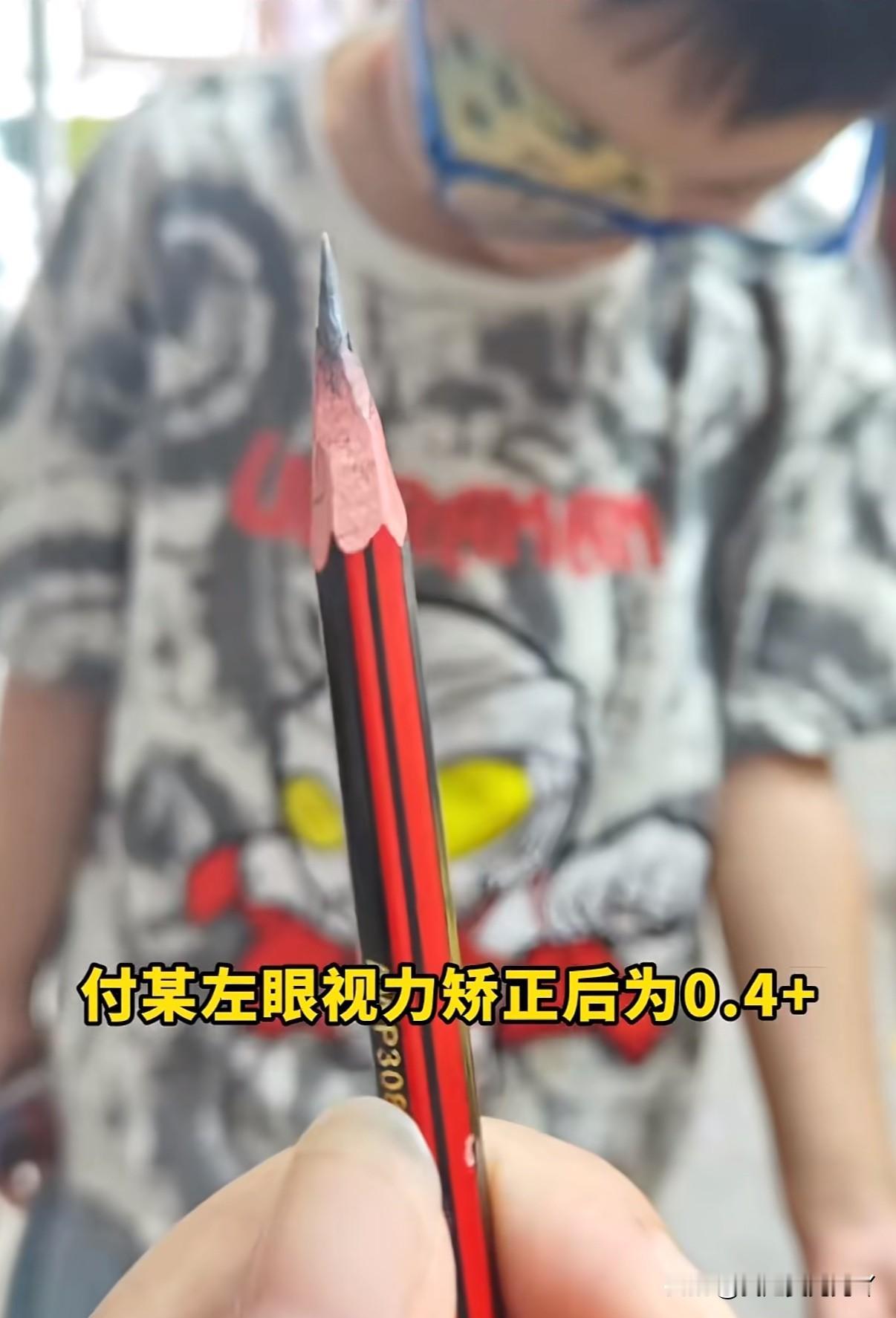 5岁男童幼儿园被同学用铅笔插眼老师发现后不通知家长不送医反而给伤口涂抹猪油导致感