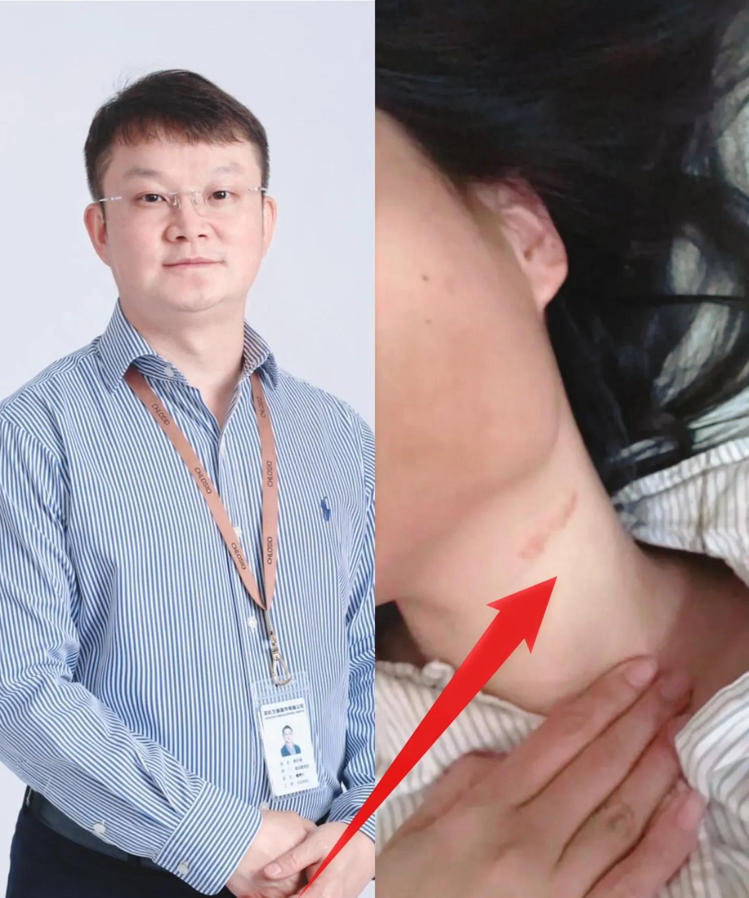 面试不合适打骨折？7月23日，深圳26岁刘女士应聘某服装公司，面试结束后