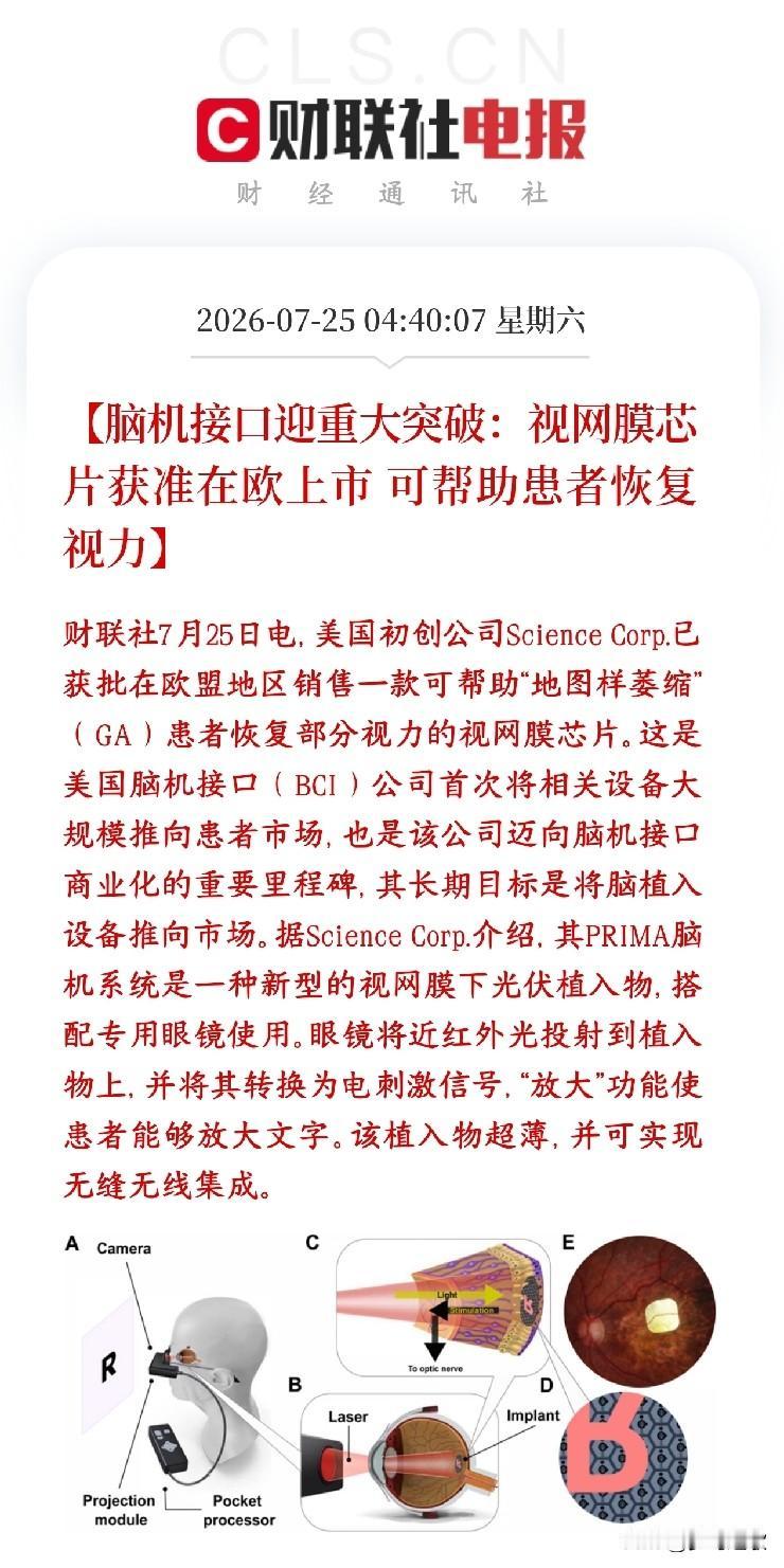 周末，脑机接口传出商用的消息，A股相关概念下周有望反弹美国研发脑机接口设备的企