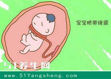 胎儿被系带缠绕两圈半, 医生却打了孕妇两下, 孩子就将脐带解开了