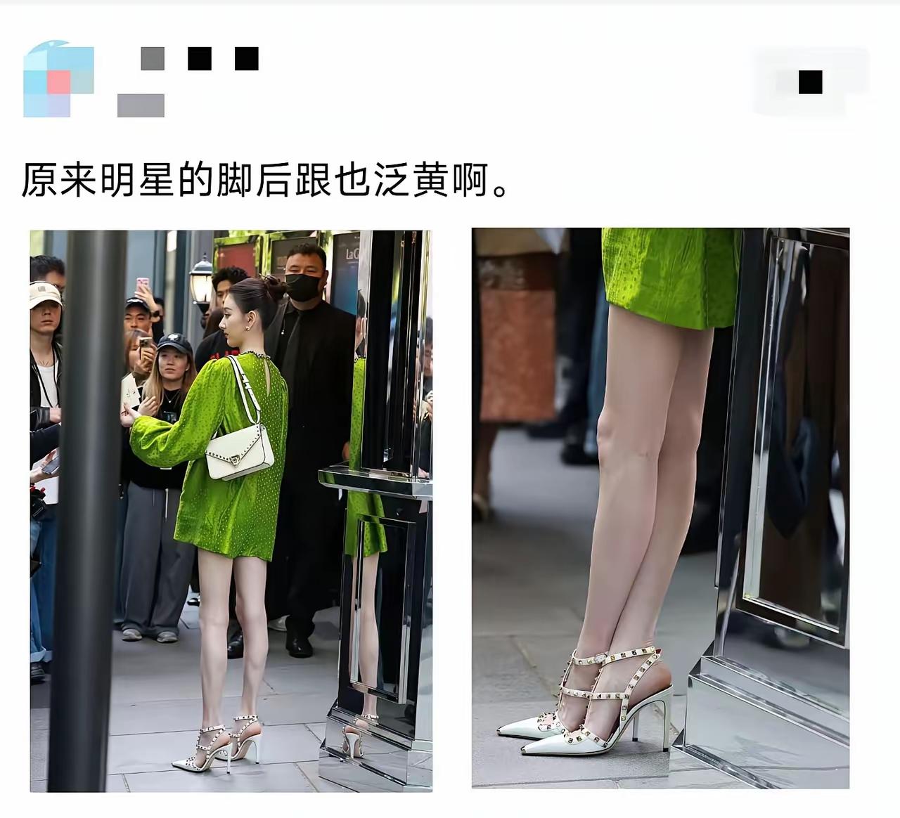 经常穿高跟鞋，感觉脚变形了。