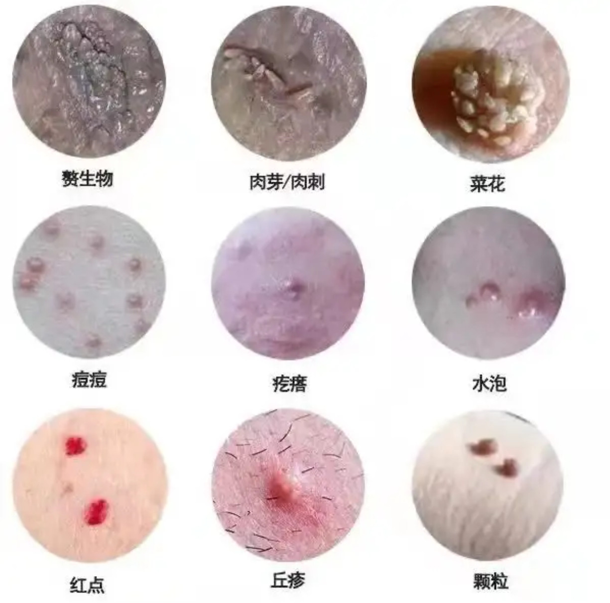 简单科普一下，看看你们有没有​​​