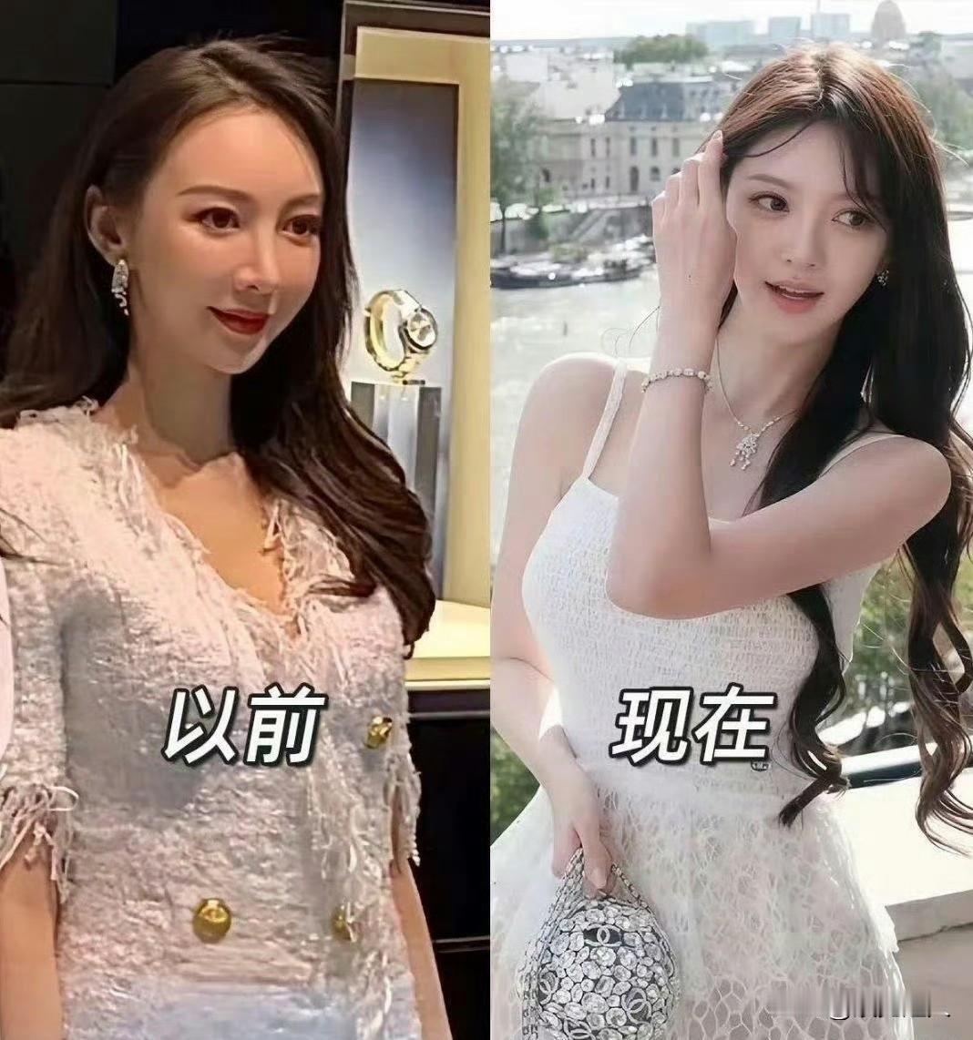 叶珂最近直播居然一点不藏着掖着，直接自曝从21岁就开始整容了！要知道明星艺人