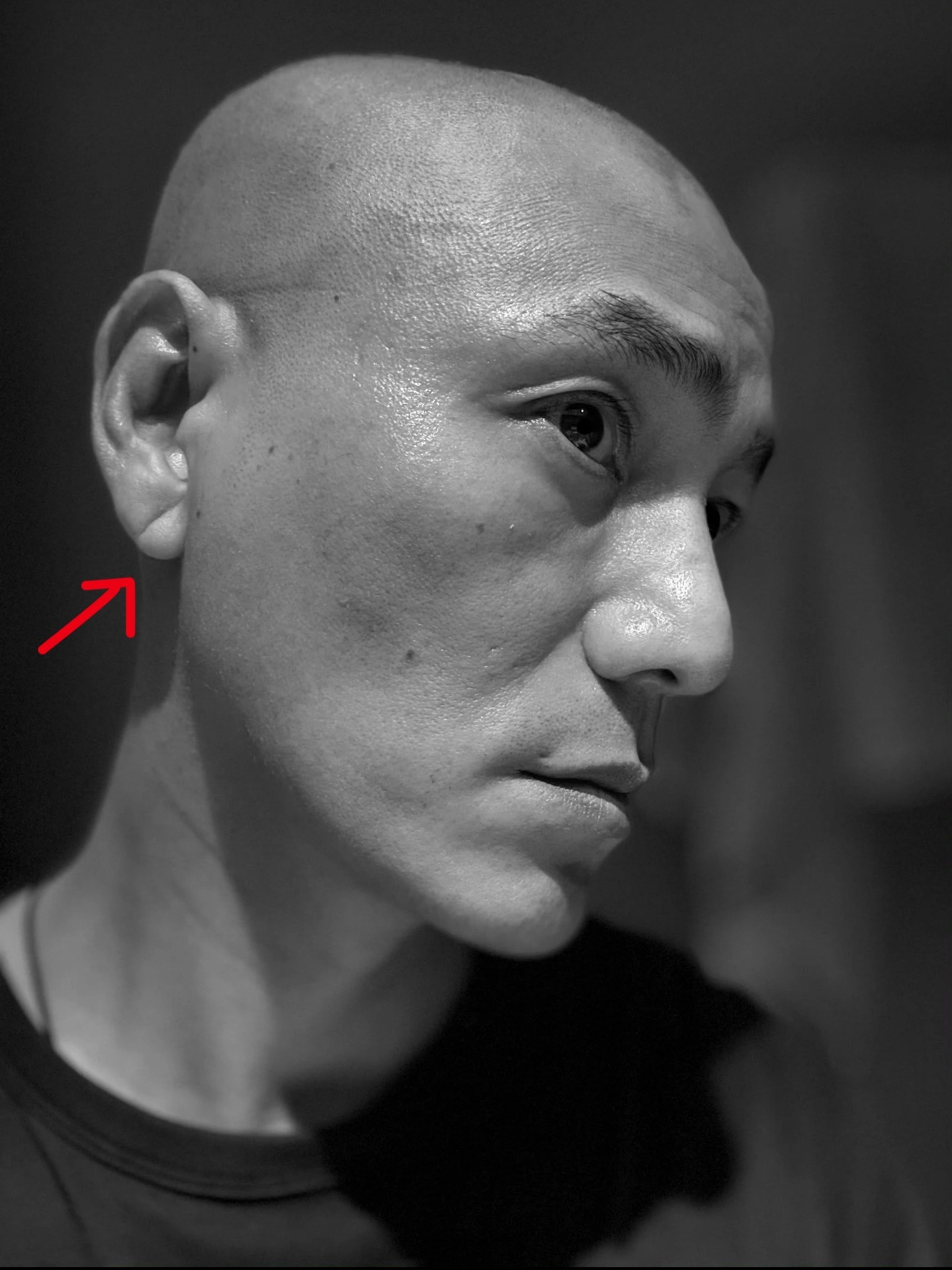 陈坤有很明显的「耳垂横纹」。「耳垂横纹」是一个很好辨认，也很值得大家注意的讯号。
