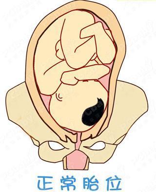 想要顺产? 这6个最重要的条件你具备了吗?
