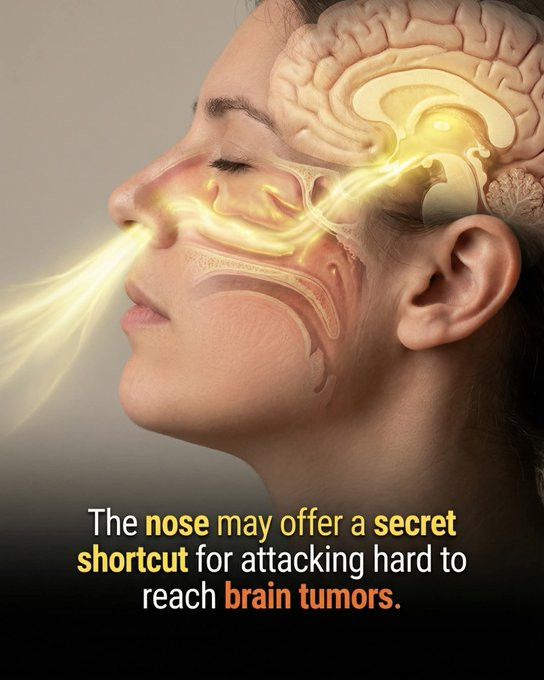 这种鼻喷剂可以通过绕过血脑屏障来治疗侵袭性脑癌。胶质母细胞瘤仍然是脑癌中最致命且