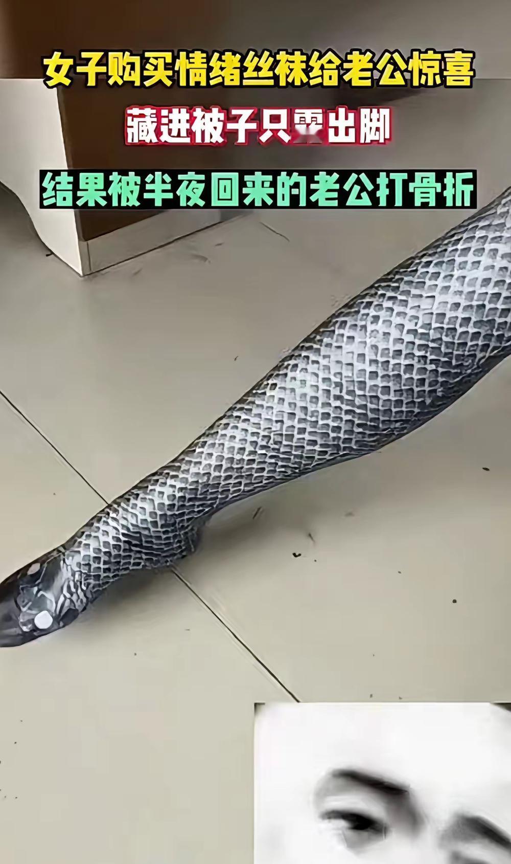 穿个情绪丝袜想给老公惊喜，结果直接被当成蛇打成骨裂，这事儿真的是搞笑又离谱。别觉