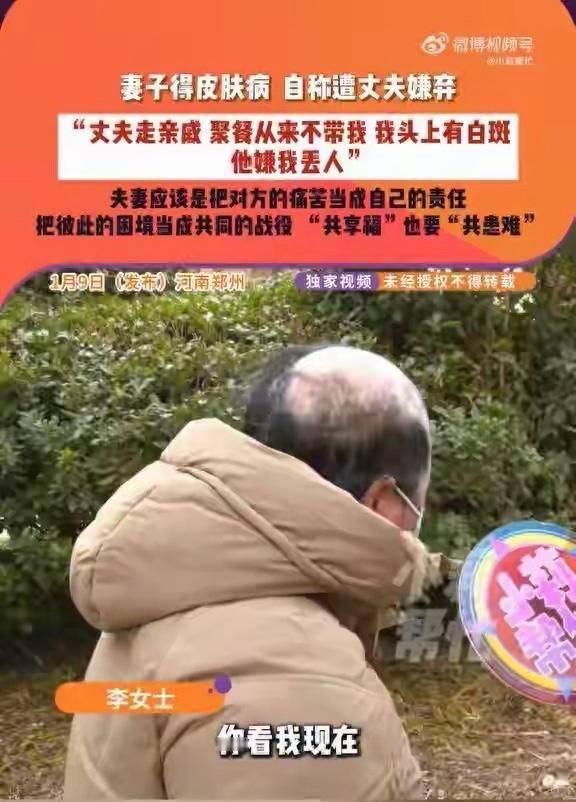 女子患病容貌大变遭离婚，“裘千尺”式悲剧背后的婚姻之问近日，河南商丘36岁女