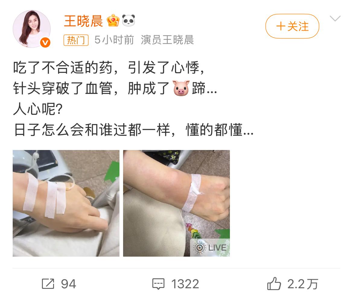 王晓晨这条微博，乍一看是吐槽看病糟心事，细品却像在借题发挥，话里有话。