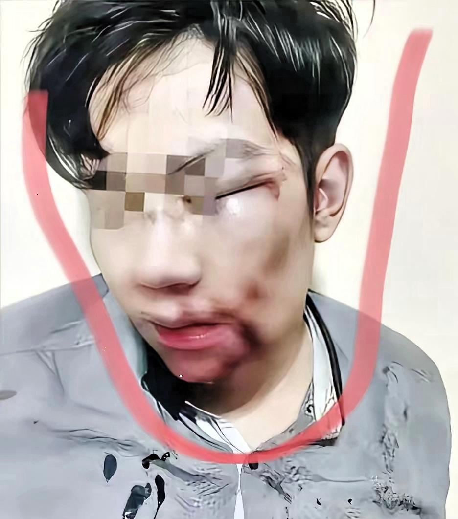 女子远嫁，老公觉得她娘家远经常家暴她。今年春节多年没有回过娘家的妻子想回娘家看看