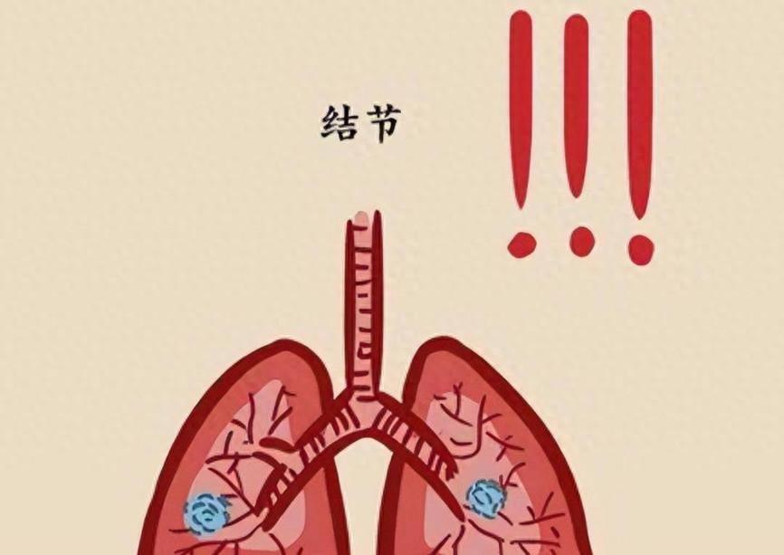 湿气重的人，结节囊肿长全身！1盒药，祛阴浊，消包块，斩草除根大家好，我是陈大