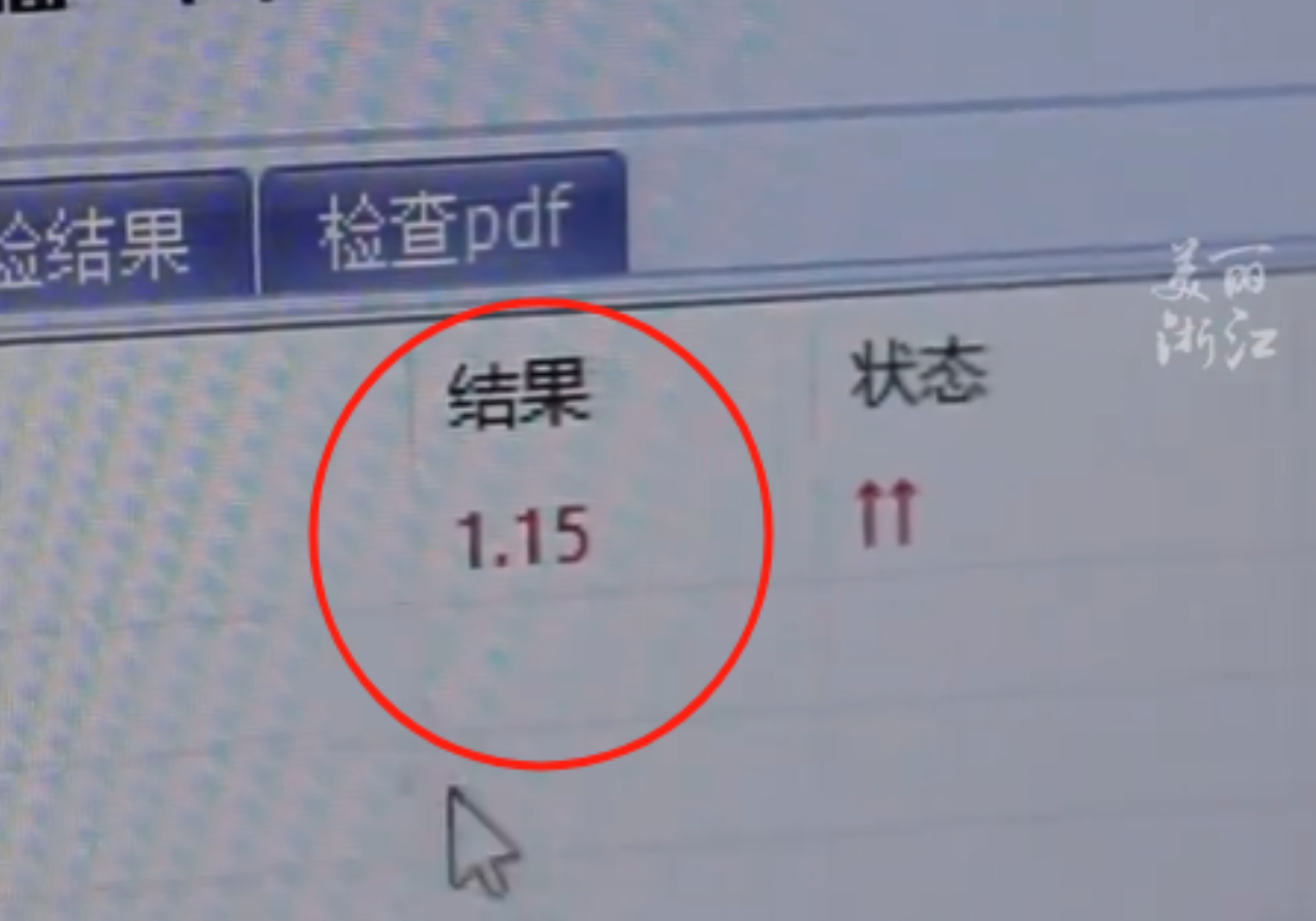 “这医生火了！”浙江，男子胸闷去医院检查，结果还没出就走了，没想到，检测报告提示